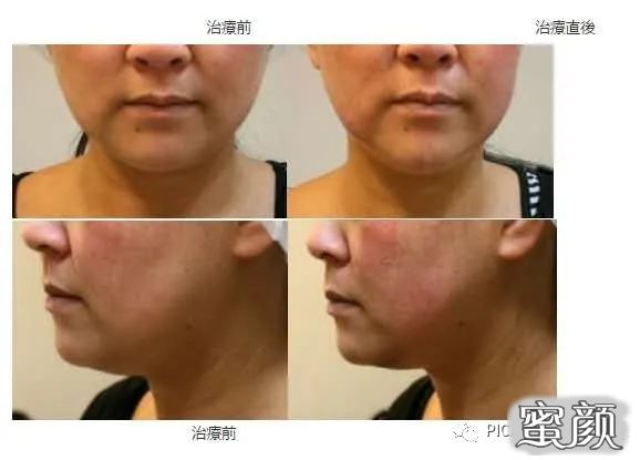 https://img.miyanlife.com/mnt/timg/200418/13164MM4-4.jpg