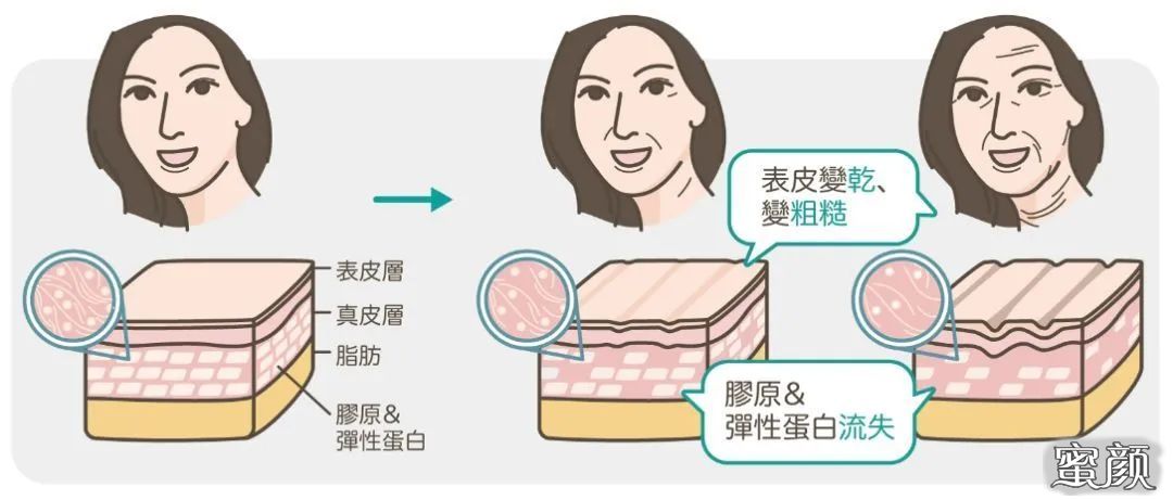 https://img.miyanlife.com/mnt/timg/200418/131Q64B6-4.jpg