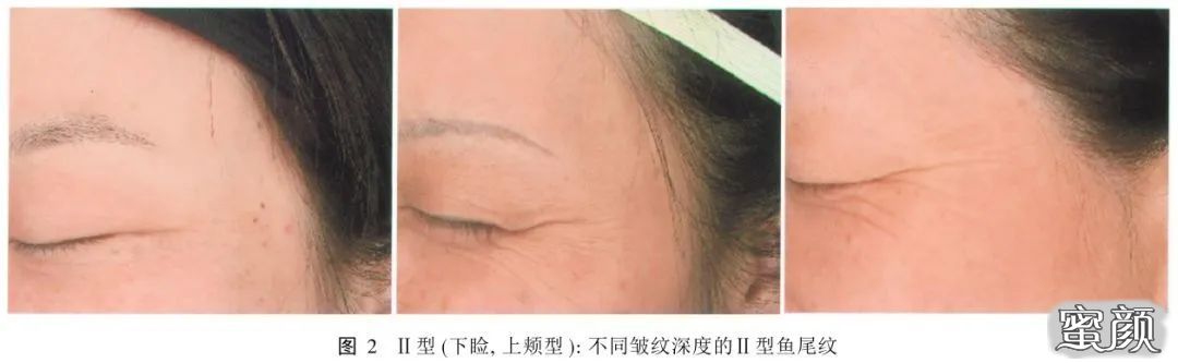 https://img.miyanlife.com/mnt/timg/200418/131QG109-7.jpg