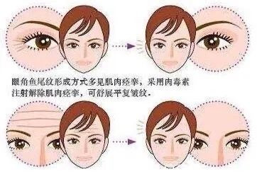https://img.miyanlife.com/mnt/timg/200418/131QK2R-5.jpg