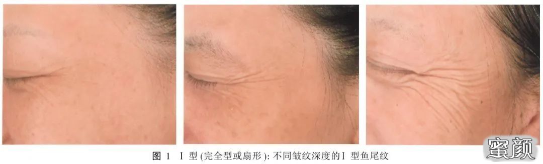 https://img.miyanlife.com/mnt/timg/200418/131QKX6-6.jpg