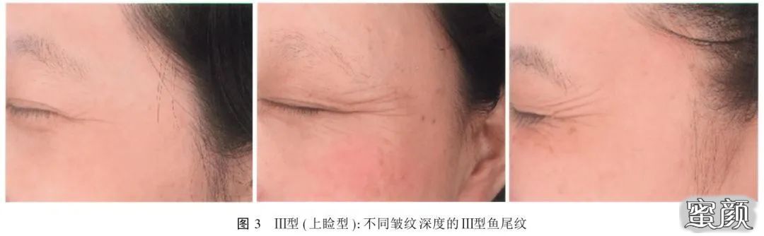 https://img.miyanlife.com/mnt/timg/200418/131QQ152-8.jpg