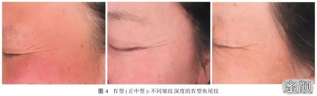 https://img.miyanlife.com/mnt/timg/200418/131QUA5-9.jpg