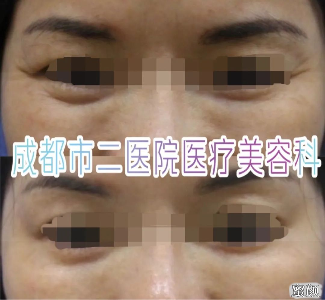 https://img.miyanlife.com/mnt/timg/200418/131R3JN-15.jpg