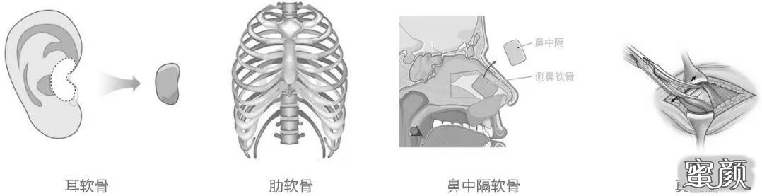 案例图片