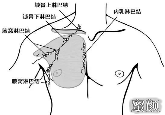 https://img.miyanlife.com/mnt/timg/200418/1406342410-14.jpg