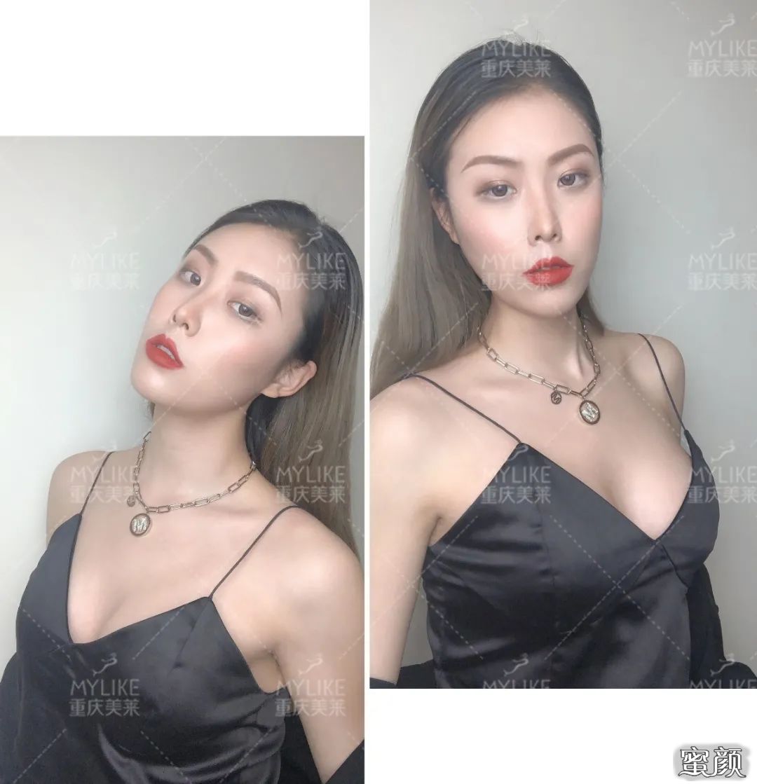 https://img.miyanlife.com/mnt/timg/200418/14125Q543-6.jpg