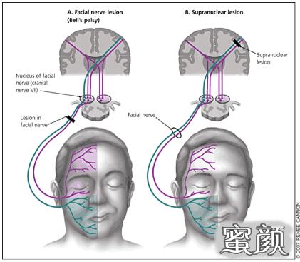 案例图片