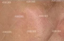 https://img.miyanlife.com/mnt/timg/200420/13445R515-6.jpg