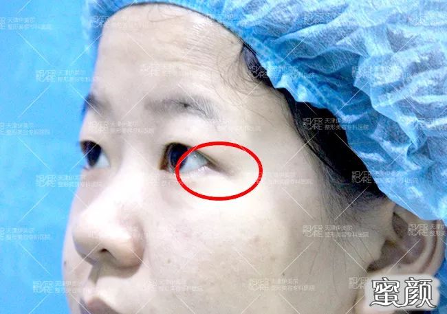 https://img.miyanlife.com/mnt/timg/200420/1401523560-2.jpg