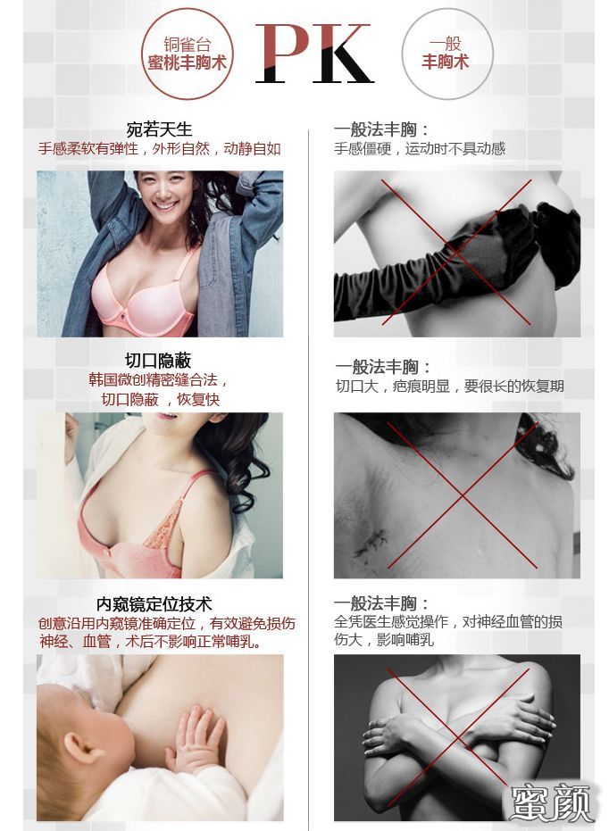 https://img.miyanlife.com/mnt/timg/200421/161TQN4-14.jpg
