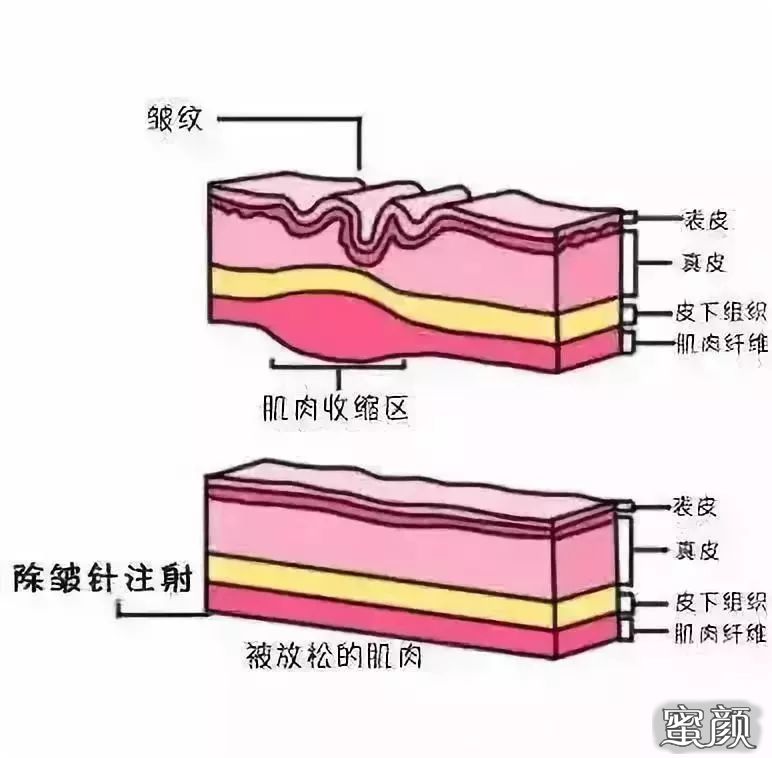 案例图片