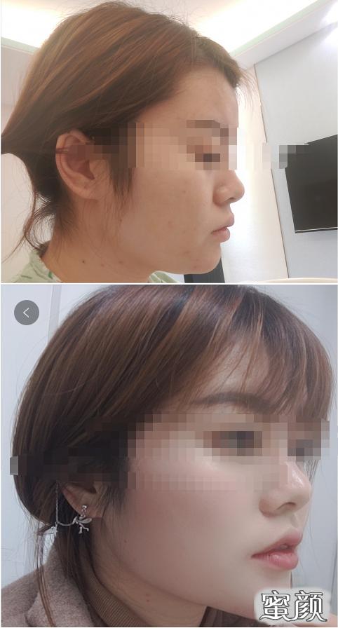 https://img.miyanlife.com/mnt/timg/200422/13402HI2-0.jpg