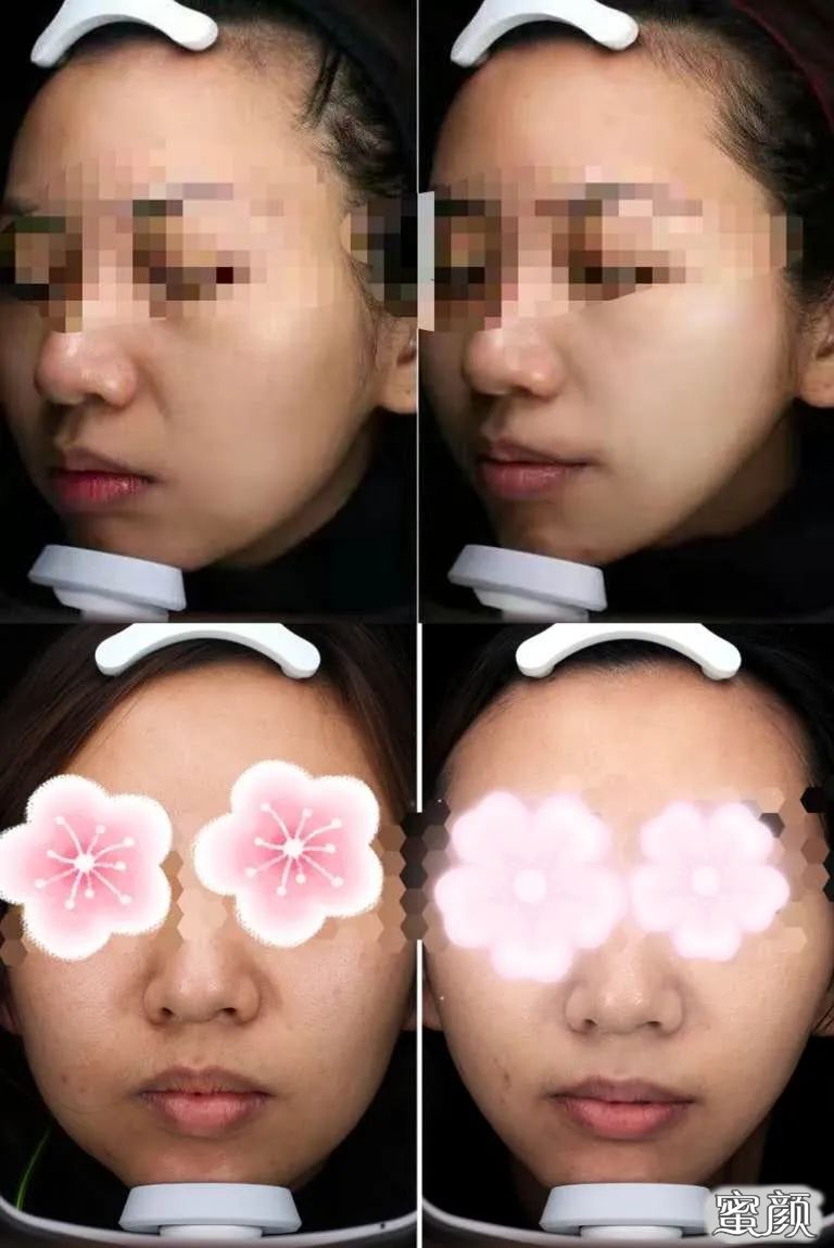 https://img.miyanlife.com/mnt/timg/200422/13402RM0-1.jpg
