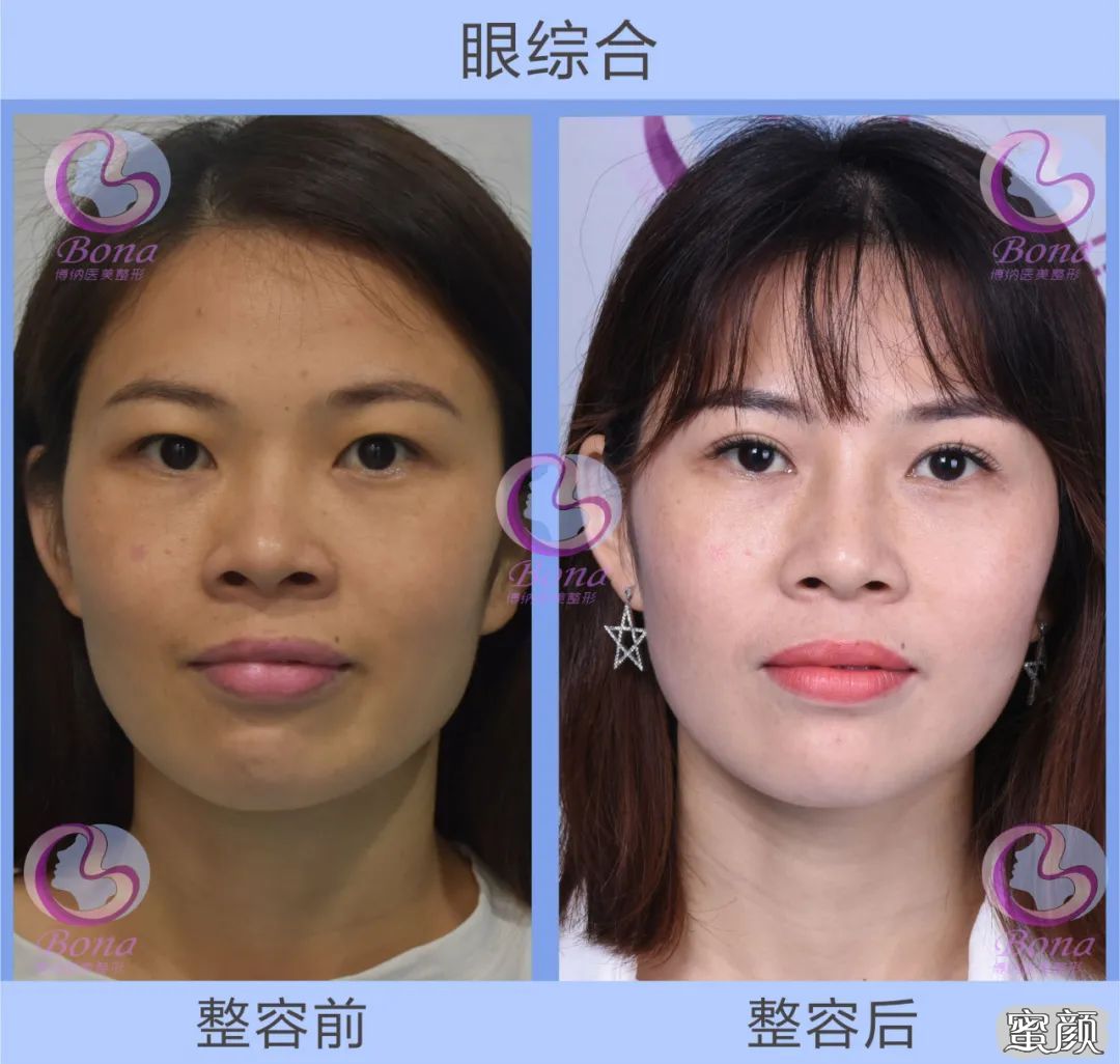 https://img.miyanlife.com/mnt/timg/200422/1433415112-6.jpg
