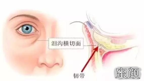https://img.miyanlife.com/mnt/timg/200422/1609163250-17.jpg