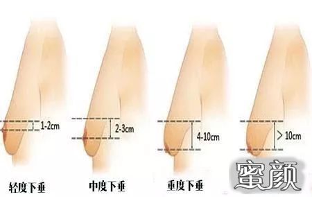 https://img.miyanlife.com/mnt/timg/200423/13292U158-11.jpg