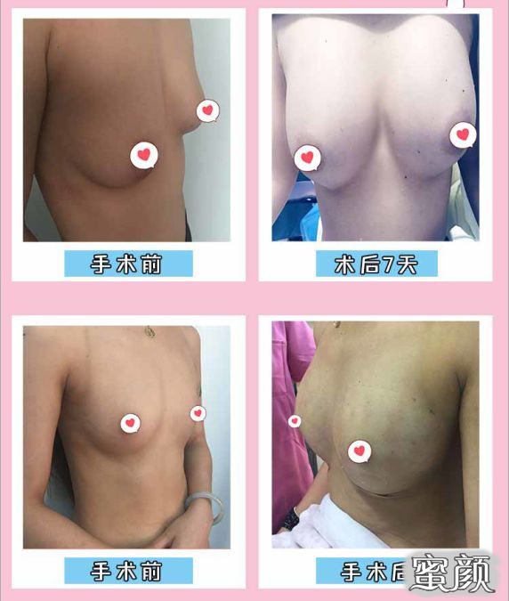 https://img.miyanlife.com/mnt/timg/200423/1342031310-4.jpg
