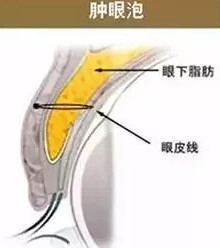 案例图片