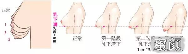 https://img.miyanlife.com/mnt/timg/200423/140R34Y7-2.jpg