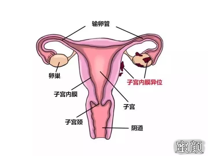 https://img.miyanlife.com/mnt/timg/200423/14140GJ4-2.jpg
