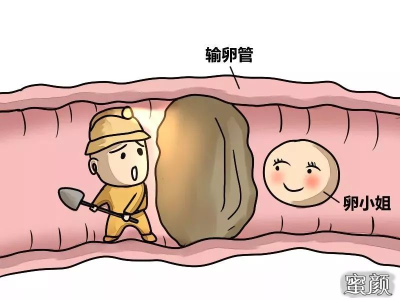 https://img.miyanlife.com/mnt/timg/200423/14140L208-1.jpg