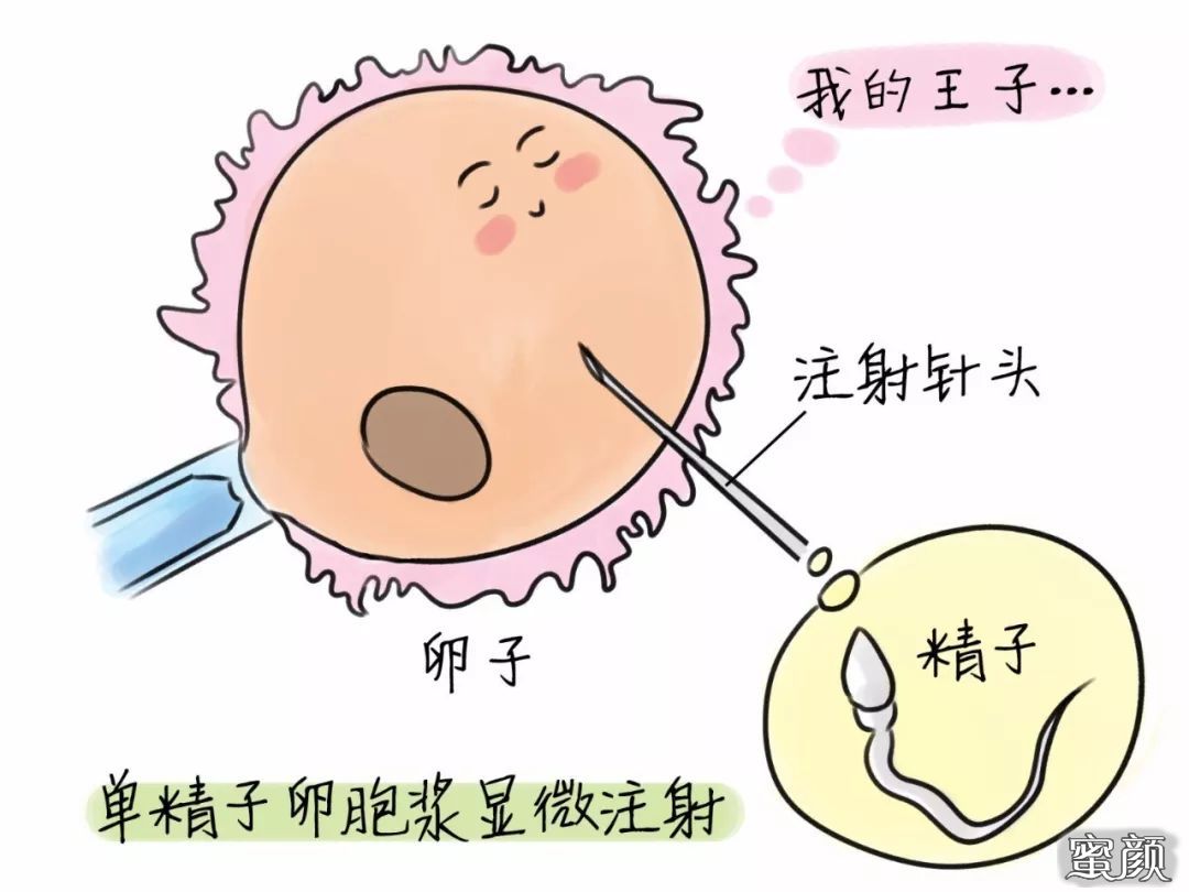 https://img.miyanlife.com/mnt/timg/200423/14140Q551-4.jpg