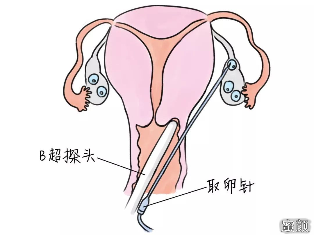 https://img.miyanlife.com/mnt/timg/200423/1414126491-9.jpg