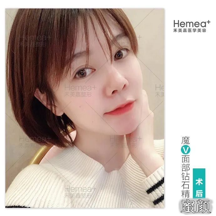 https://img.miyanlife.com/mnt/timg/200423/153R051X-0.jpg