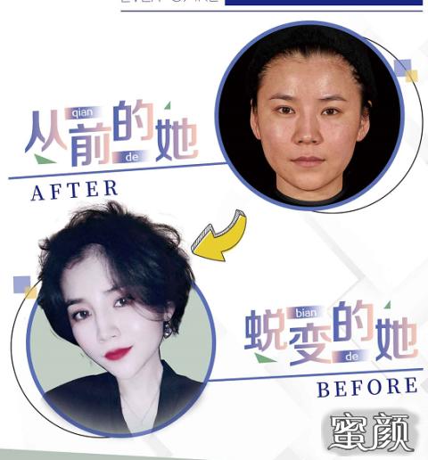 https://img.miyanlife.com/mnt/timg/200424/163934A16-2.jpg