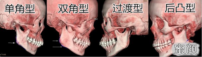 案例图片