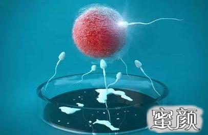 https://img.miyanlife.com/mnt/timg/200425/1ZFGF7-3.jpg