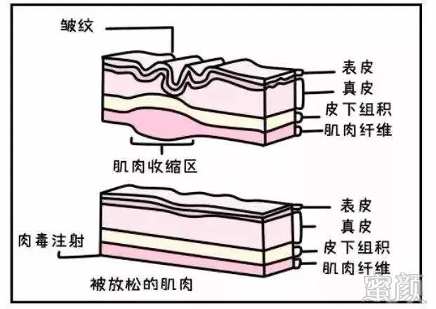 https://img.miyanlife.com/mnt/timg/200427/14414240L-3.jpg