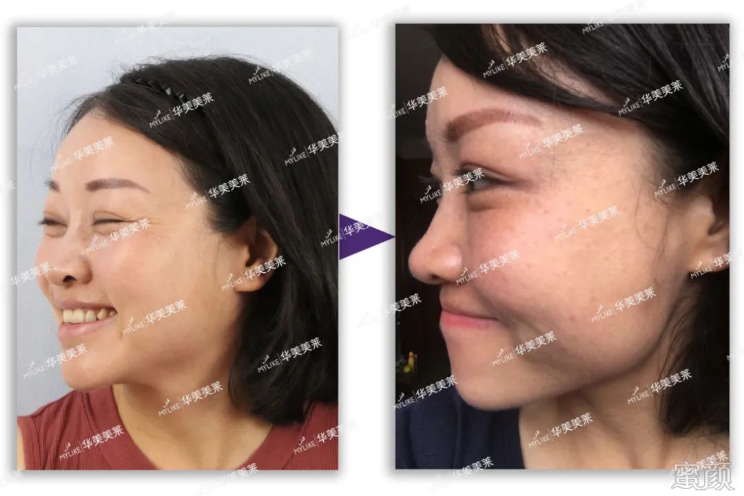 https://img.miyanlife.com/mnt/timg/200427/1441436047-5.jpg