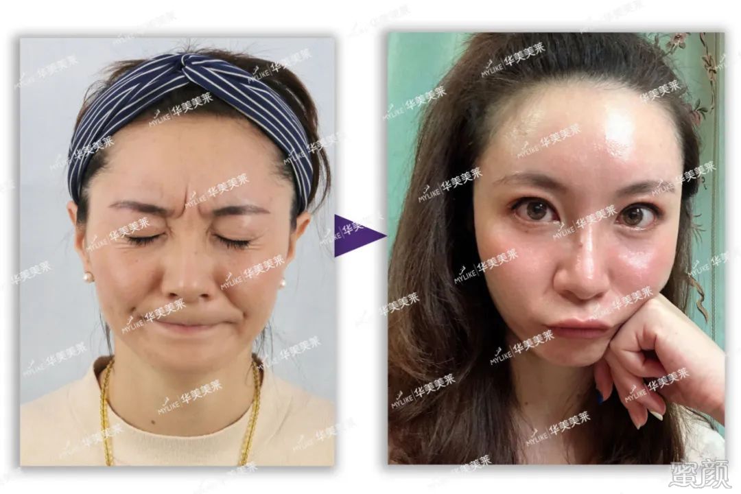 https://img.miyanlife.com/mnt/timg/200427/1441462048-7.jpg