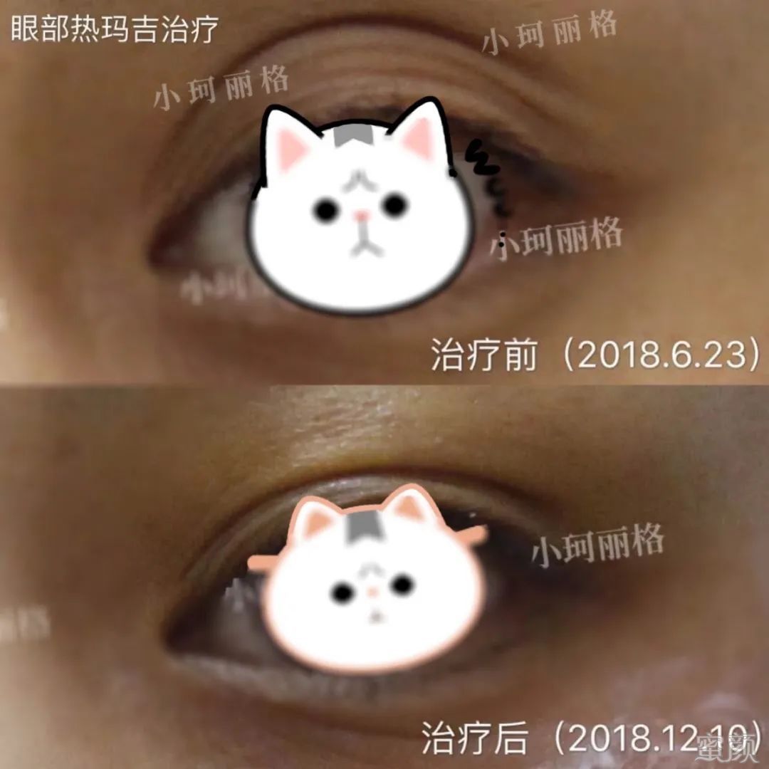 https://img.miyanlife.com/mnt/timg/200427/15303221L-2.jpg