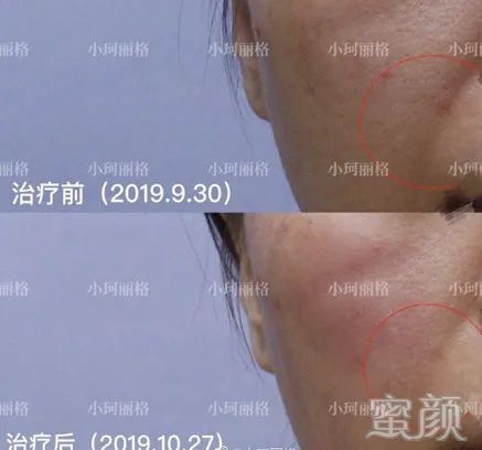 https://img.miyanlife.com/mnt/timg/200427/1530345A3-3.jpg