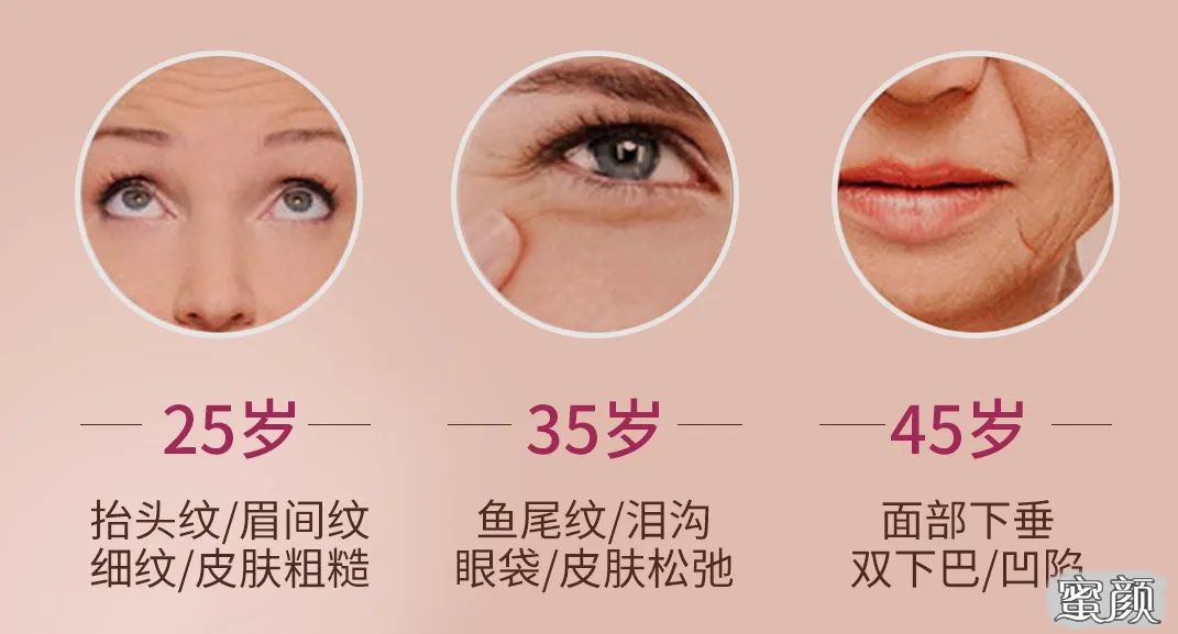https://img.miyanlife.com/mnt/timg/200428/1230452064-0.jpg