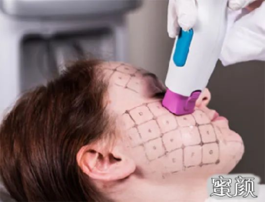https://img.miyanlife.com/mnt/timg/200428/12305263B-3.jpg