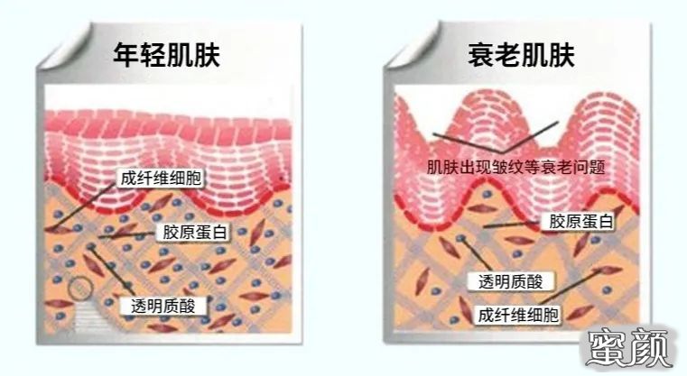 https://img.miyanlife.com/mnt/timg/200428/1230561550-6.jpg