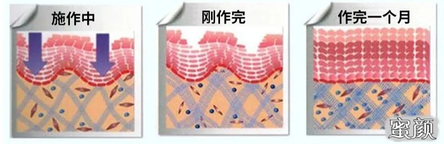 https://img.miyanlife.com/mnt/timg/200428/12305U229-7.jpg