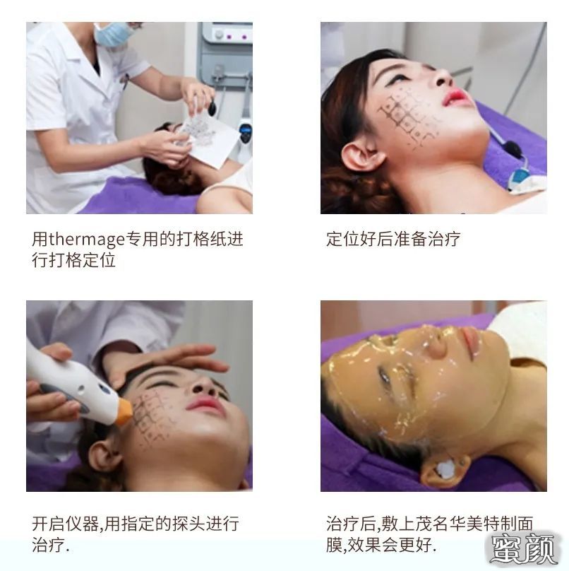 https://img.miyanlife.com/mnt/timg/200428/1231001c9-8.jpg