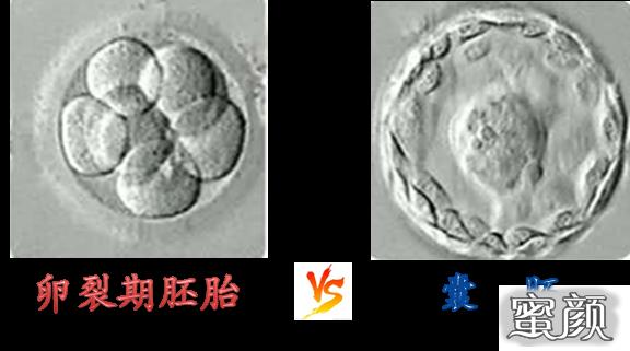 https://img.miyanlife.com/mnt/timg/200428/1350151514-3.jpg