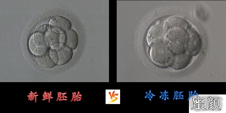 https://img.miyanlife.com/mnt/timg/200428/13501Q550-5.jpg