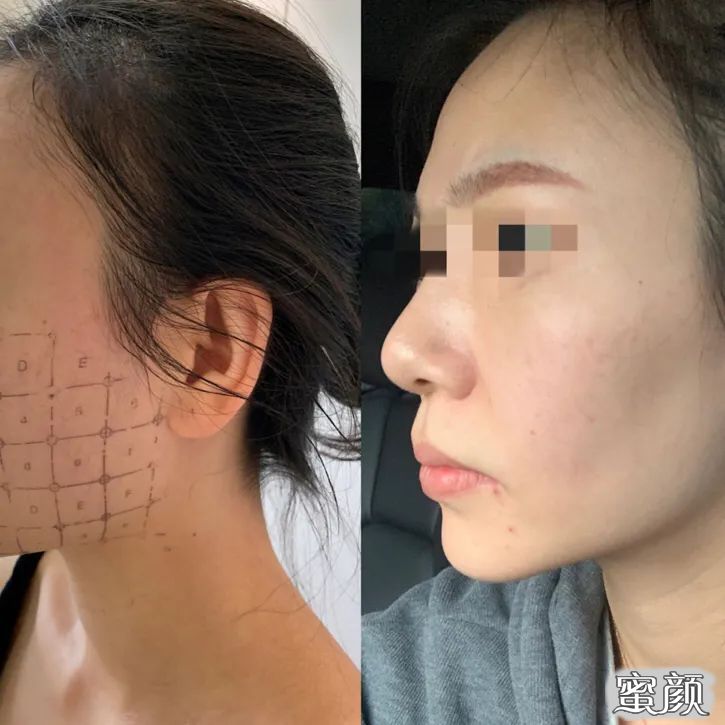 https://img.miyanlife.com/mnt/timg/200429/1423534H2-9.jpg