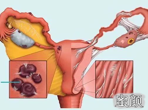 https://img.miyanlife.com/mnt/timg/200429/1603025041-1.jpg