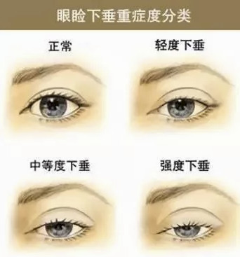 https://img.miyanlife.com/mnt/timg/200430/1314033H6-13.jpg