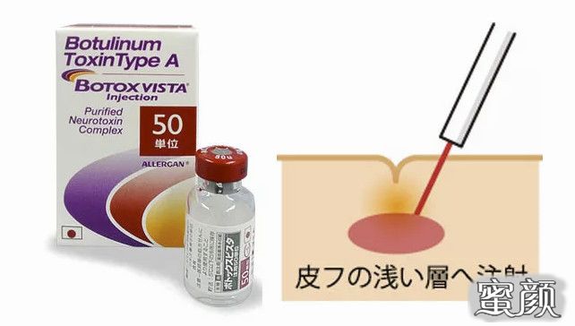 https://img.miyanlife.com/mnt/timg/200430/1314192V3-15.jpg
