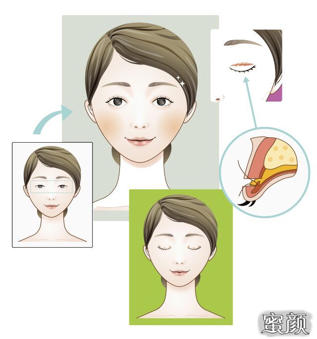 https://img.miyanlife.com/mnt/timg/200430/133I121c-2.jpg