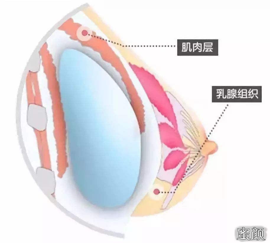 案例图片